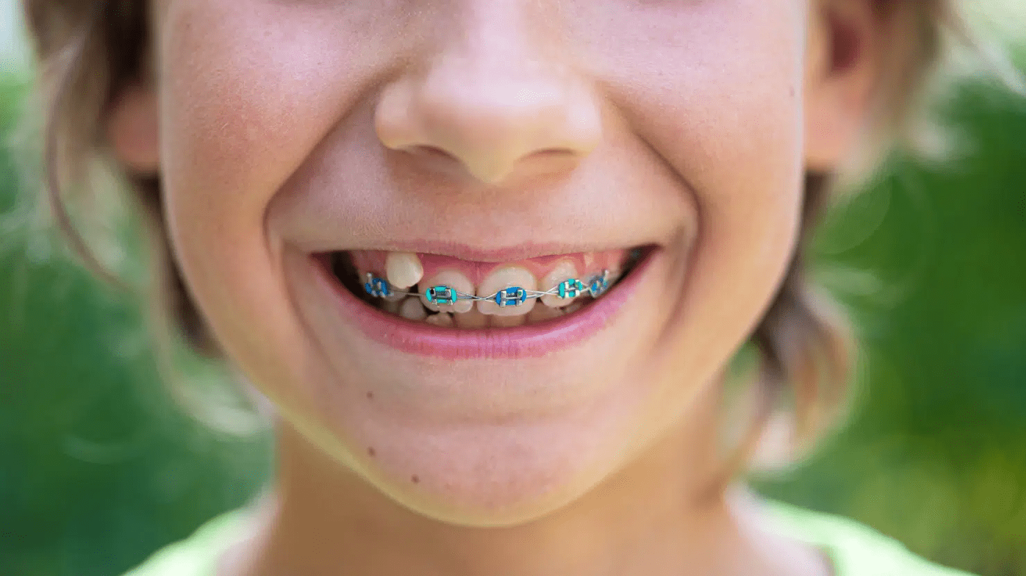 braces lee's summit